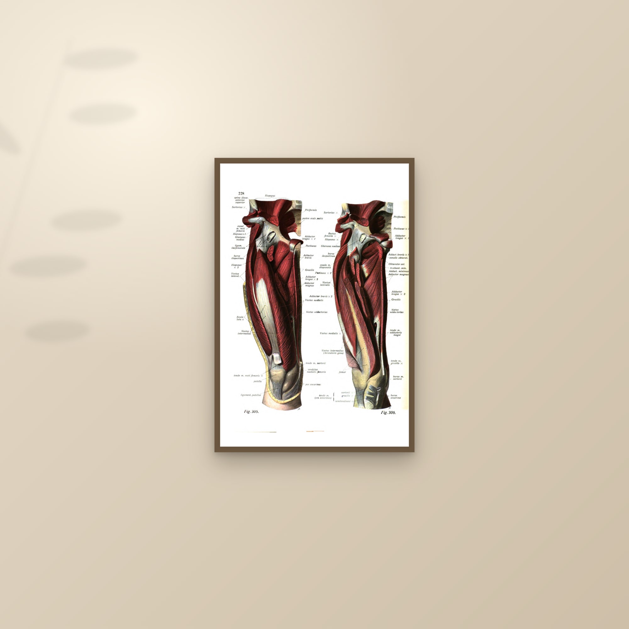 Muscles of the Thigh (two front views) — framed and styled on a sunlit wall