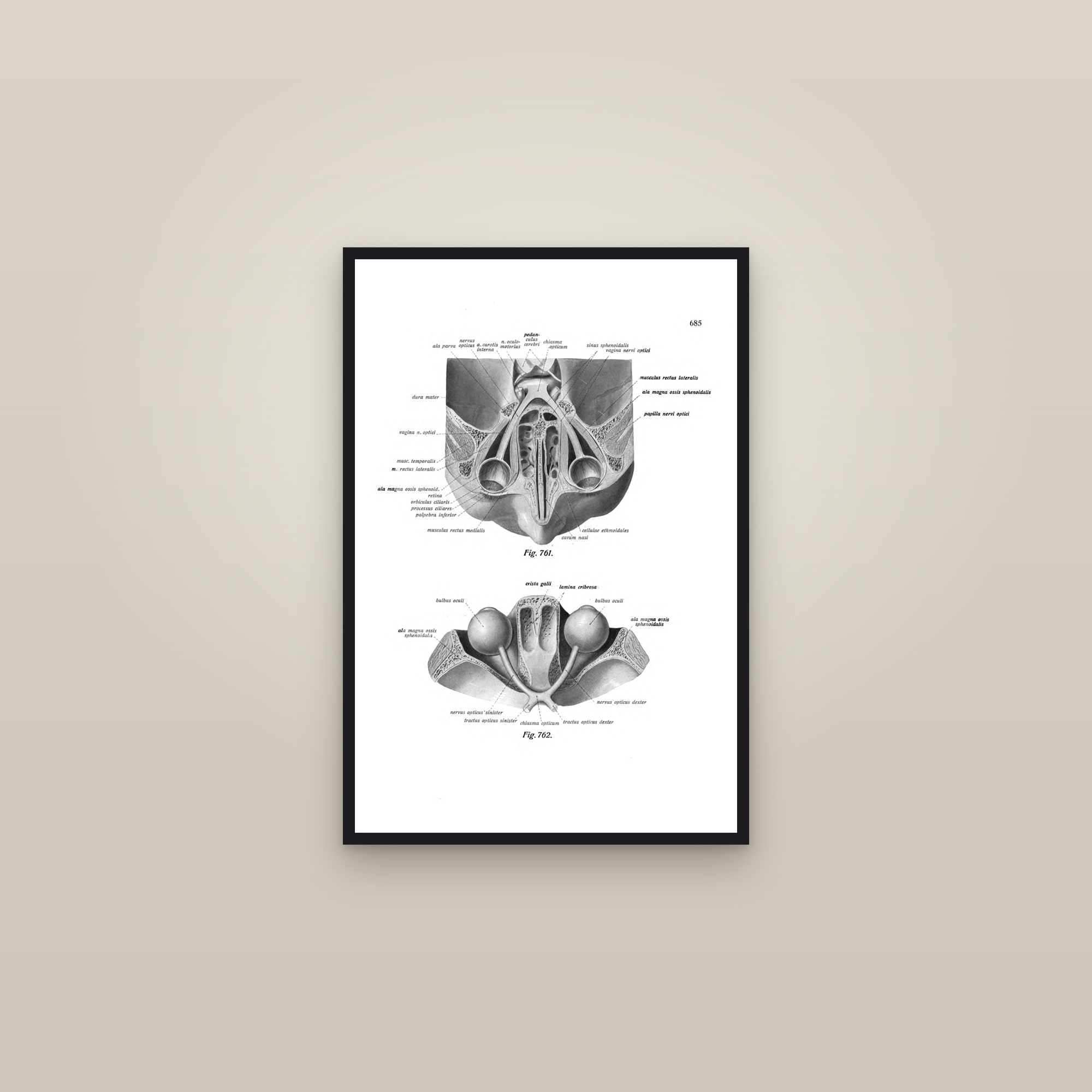 The Orbit and Eye Muscles — framed in a gallery setting