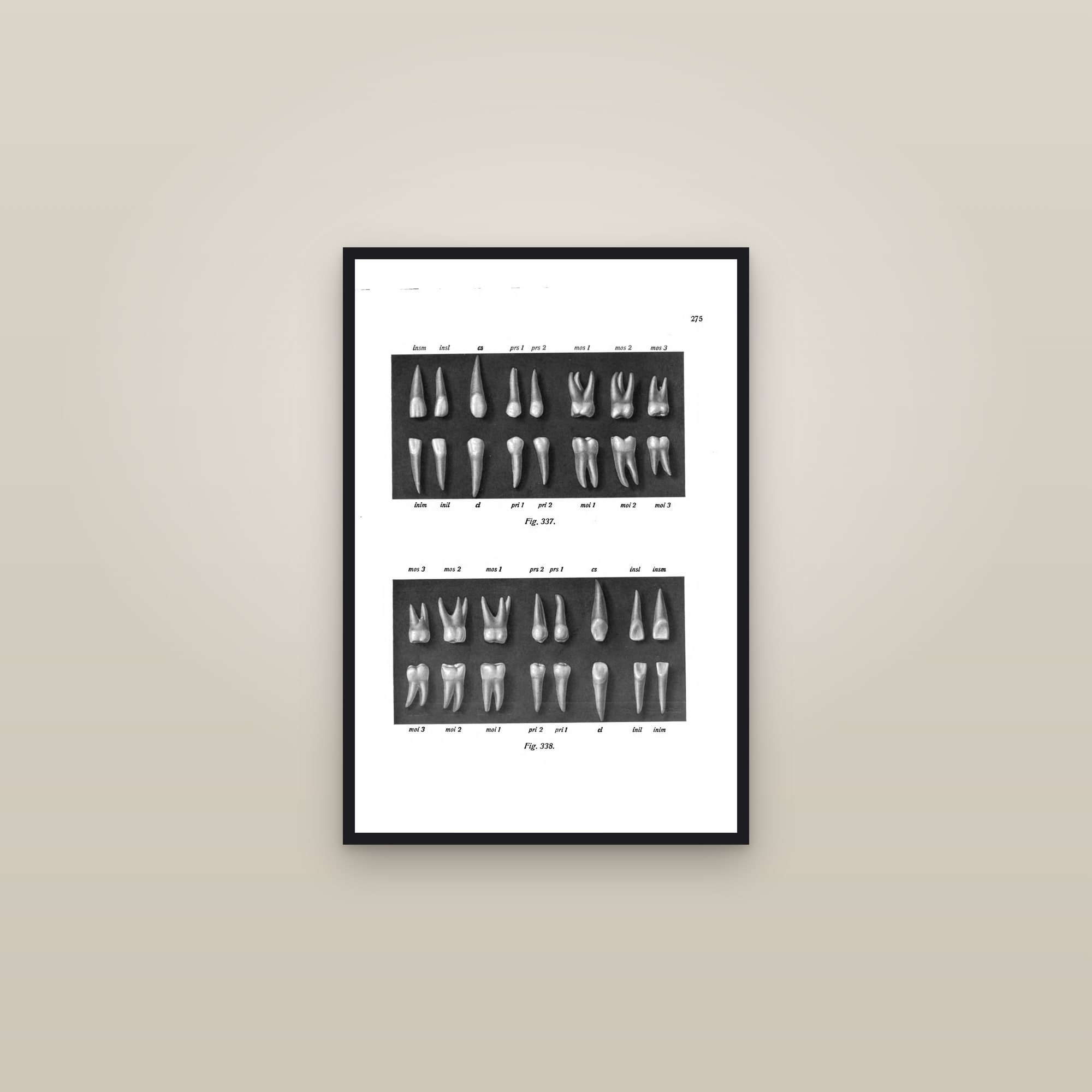 The Permanent Teeth (upper and lower dentition) — framed in a gallery setting