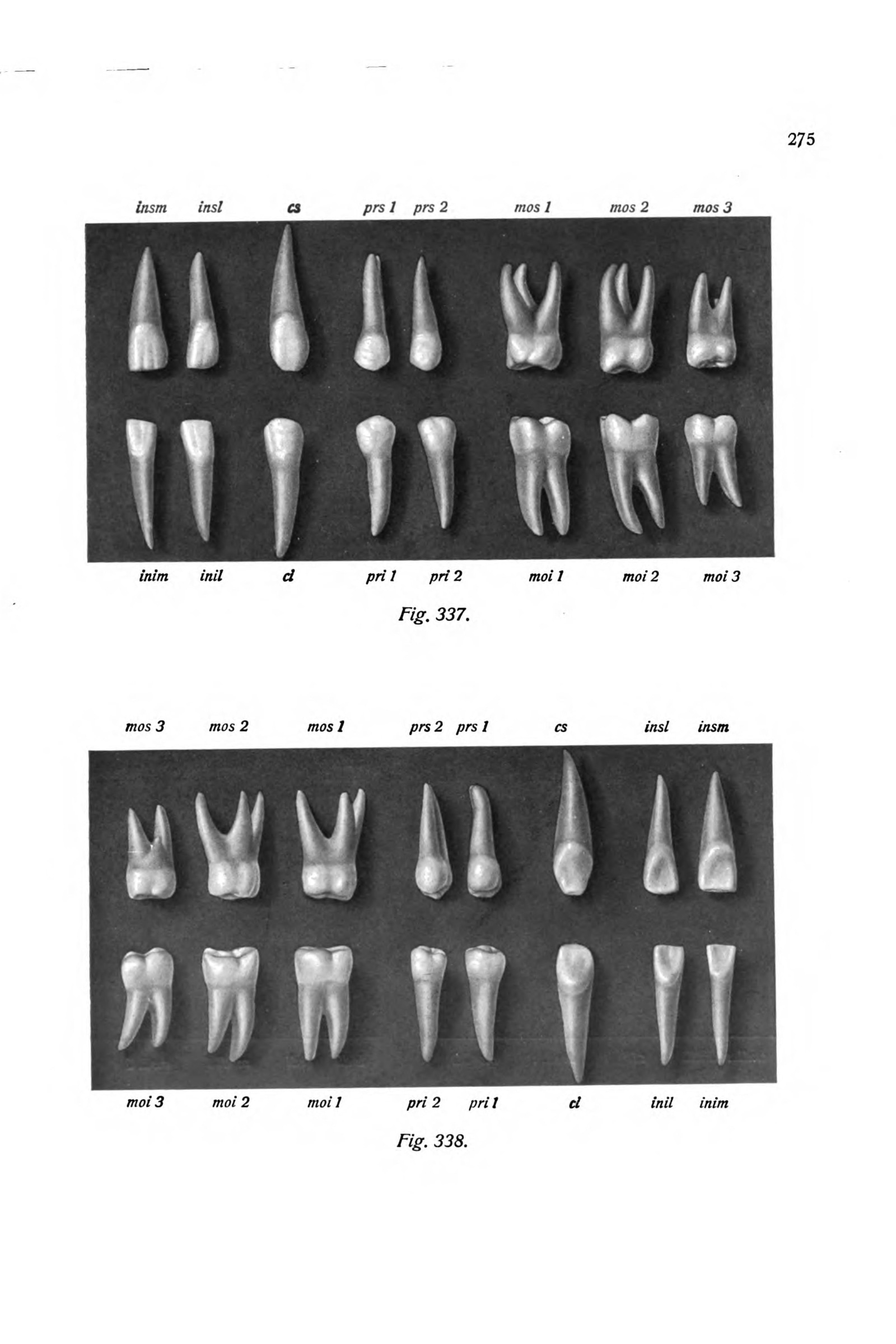 The Permanent Teeth (upper and lower dentition)