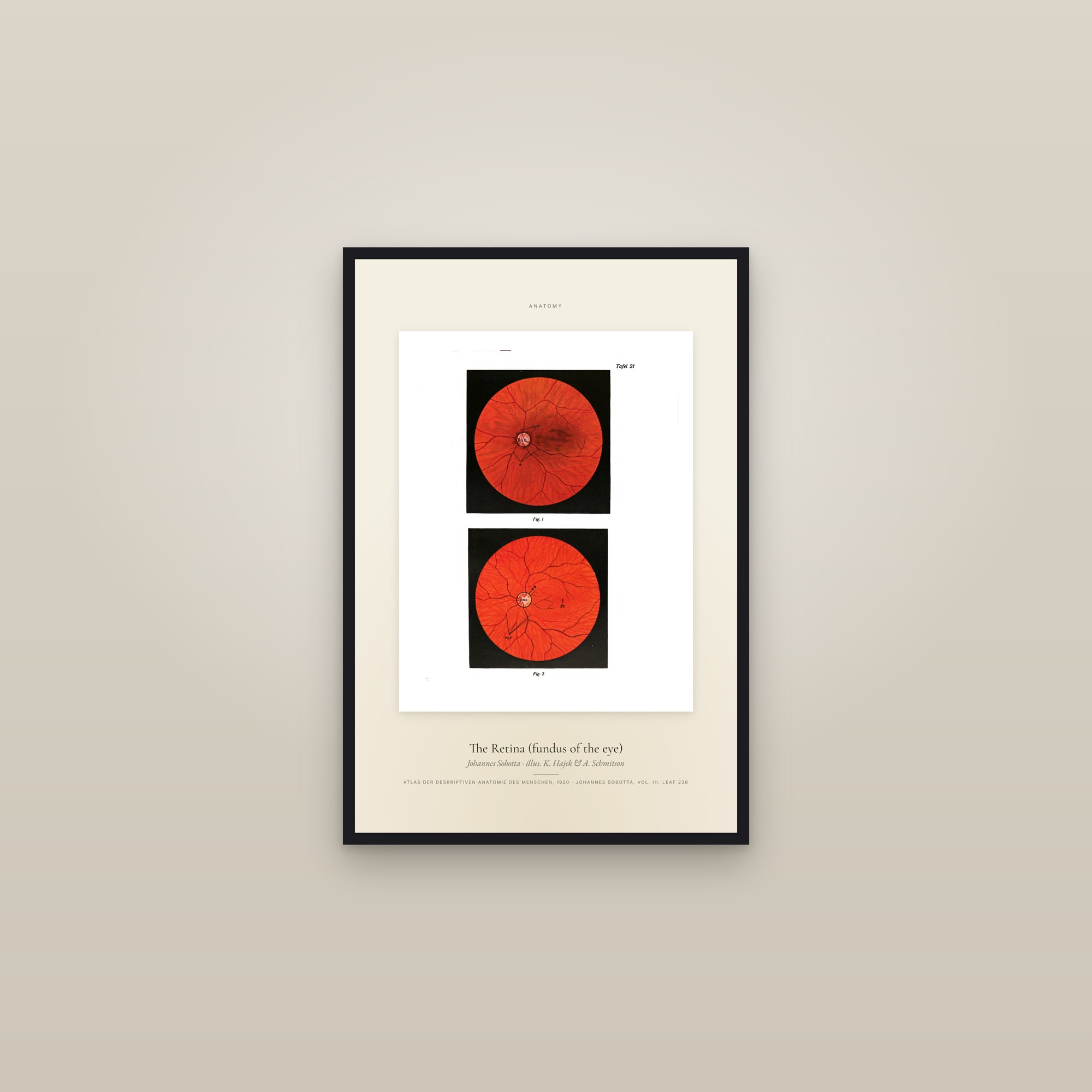 The Retina (fundus of the eye) — Specimen — framed in a gallery setting