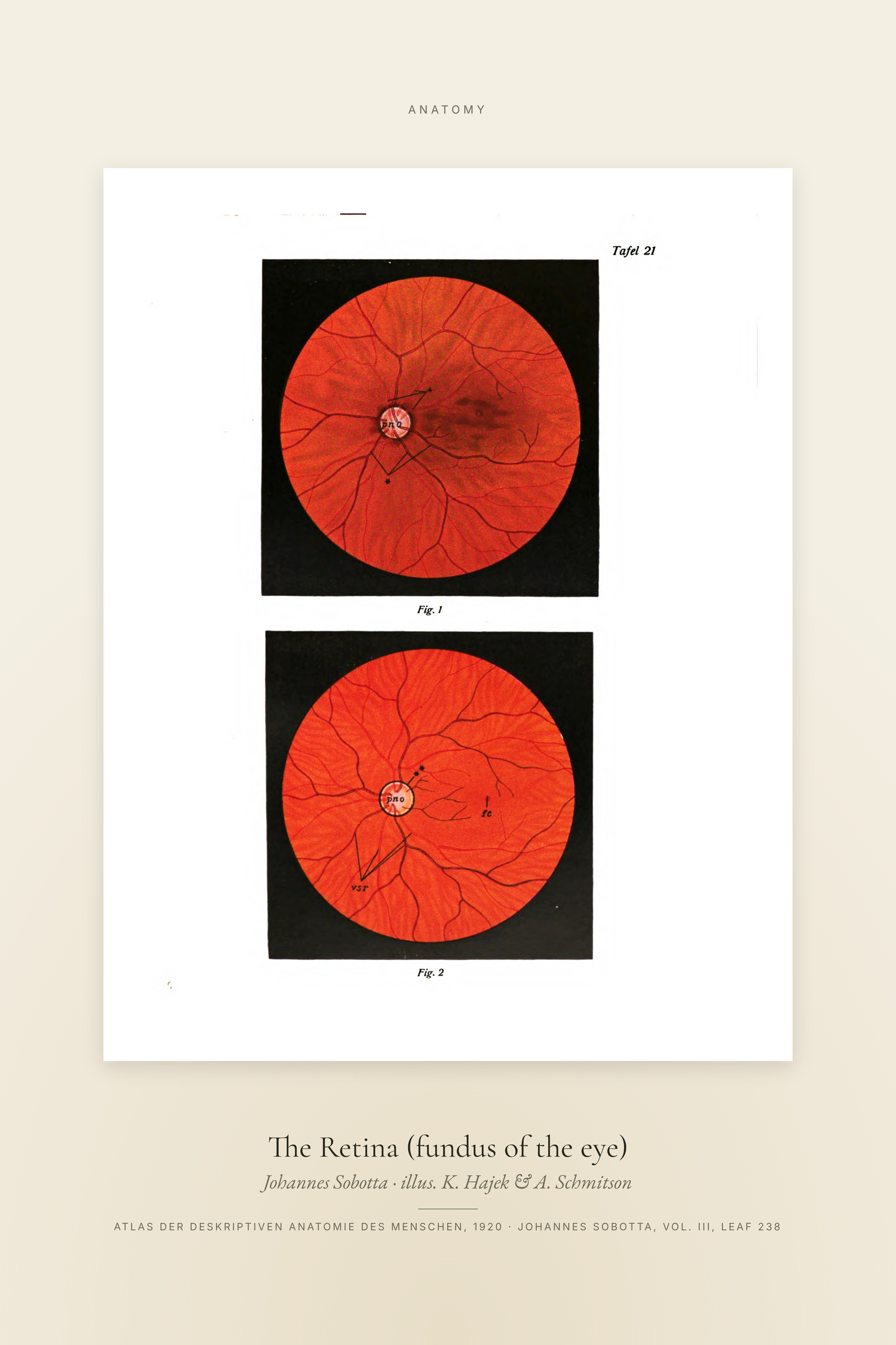 The Retina (fundus of the eye) — Specimen