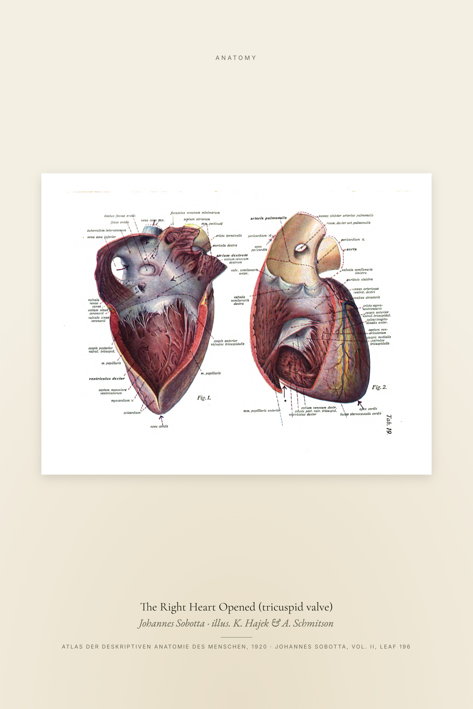 The Right Heart Opened (tricuspid valve)