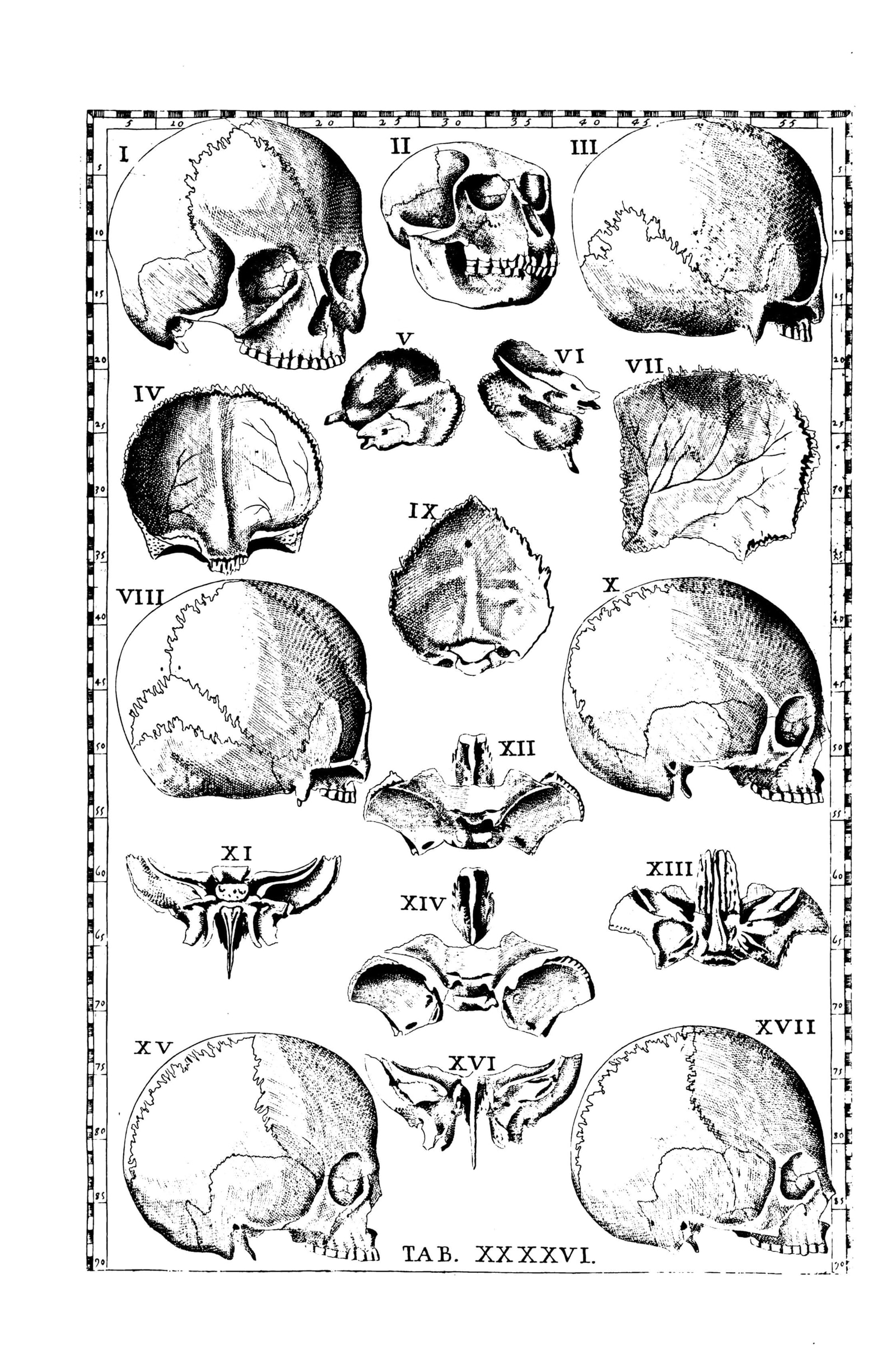 The Human Skull (seventeen views)