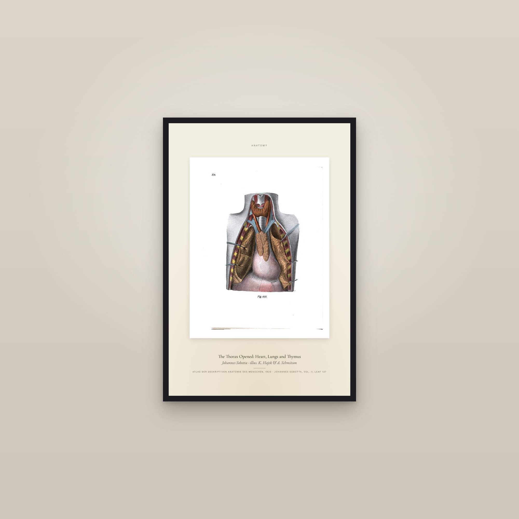 The Thorax Opened: Heart, Lungs and Thymus — Specimen — framed in a gallery setting