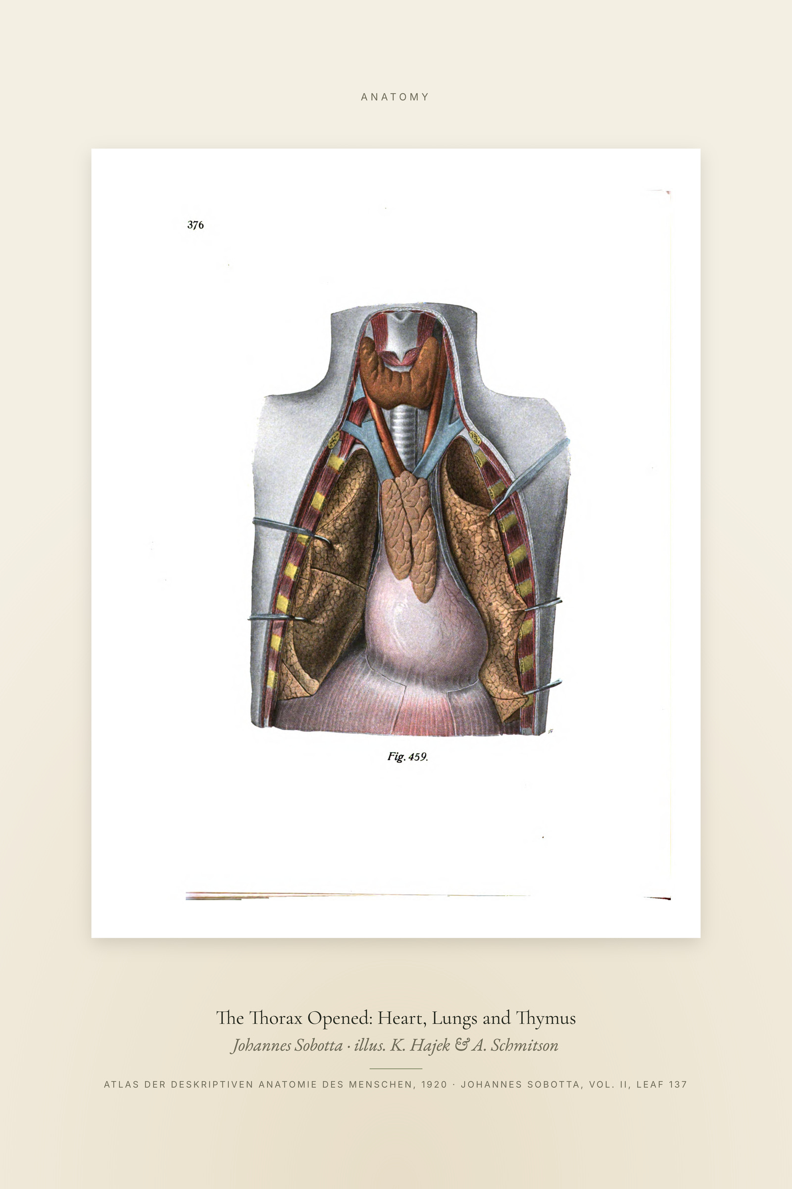 The Thorax Opened: Heart, Lungs and Thymus — Specimen