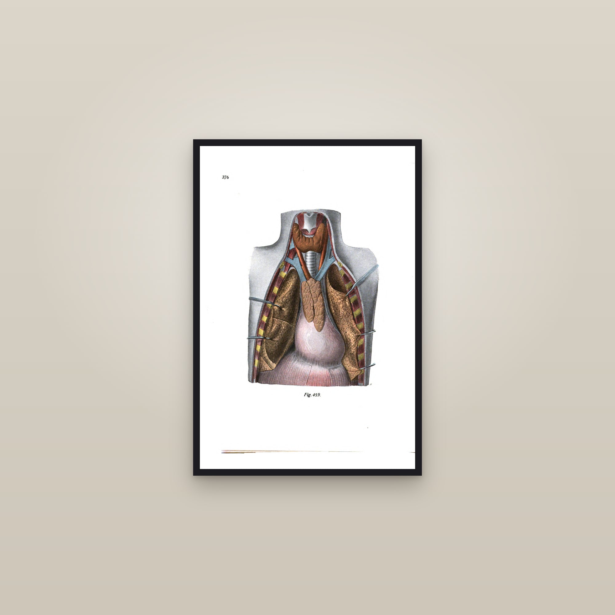 The Thorax Opened: Heart, Lungs and Thymus — framed in a gallery setting