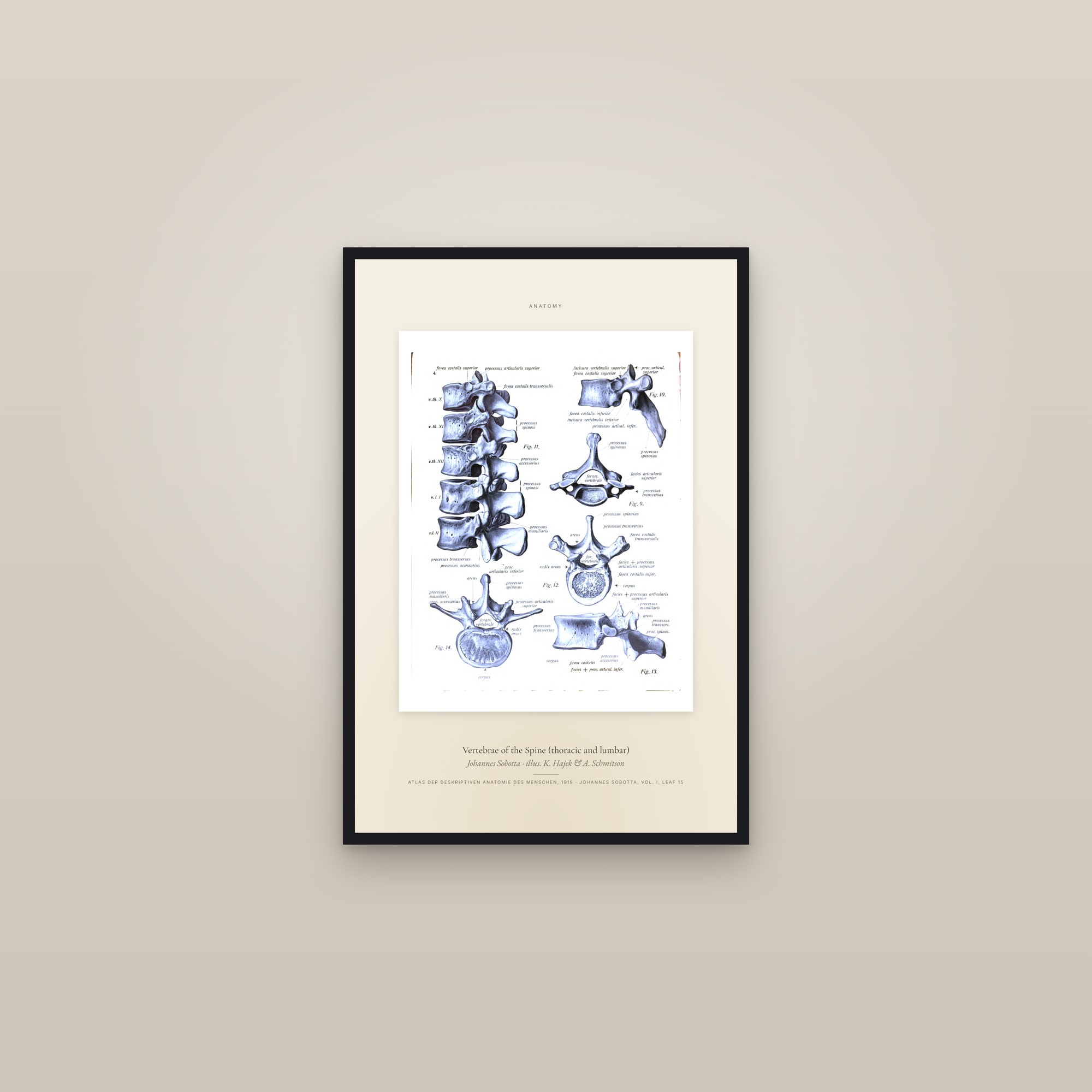 Vertebrae of the Spine (thoracic and lumbar) — Specimen — framed in a gallery setting