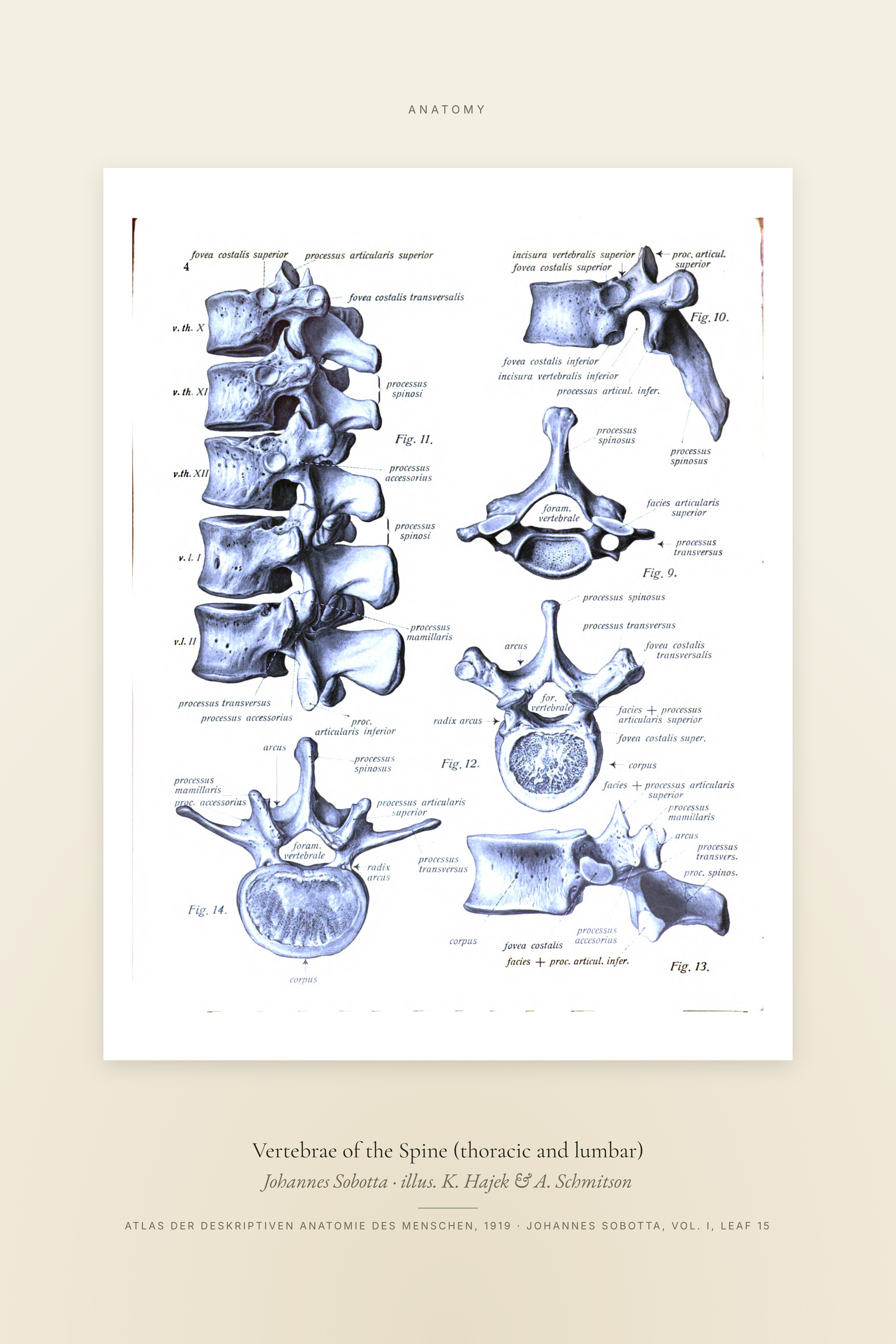 Vertebrae of the Spine (thoracic and lumbar) — Specimen