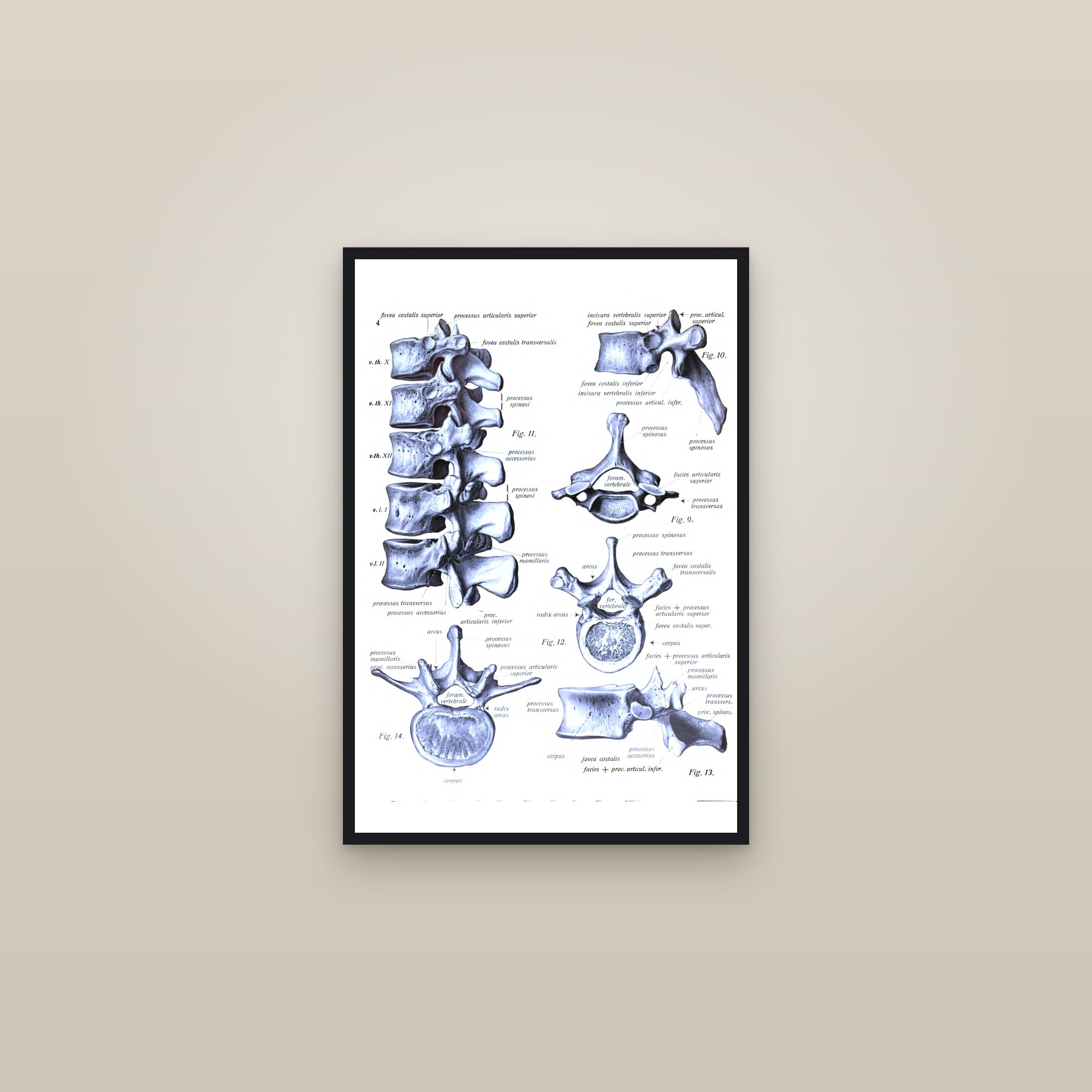 Vertebrae of the Spine (thoracic and lumbar) — framed in a gallery setting