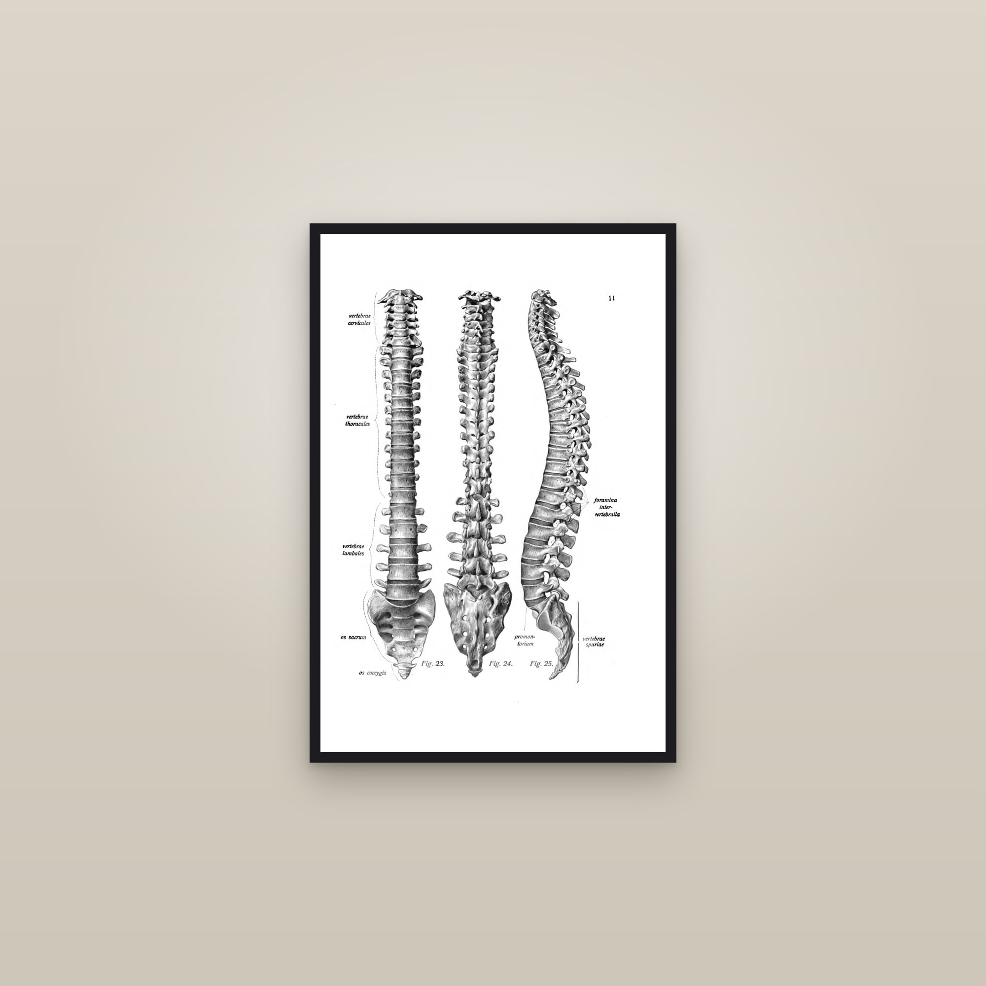 The Vertebral Column (three views) — framed in a gallery setting
