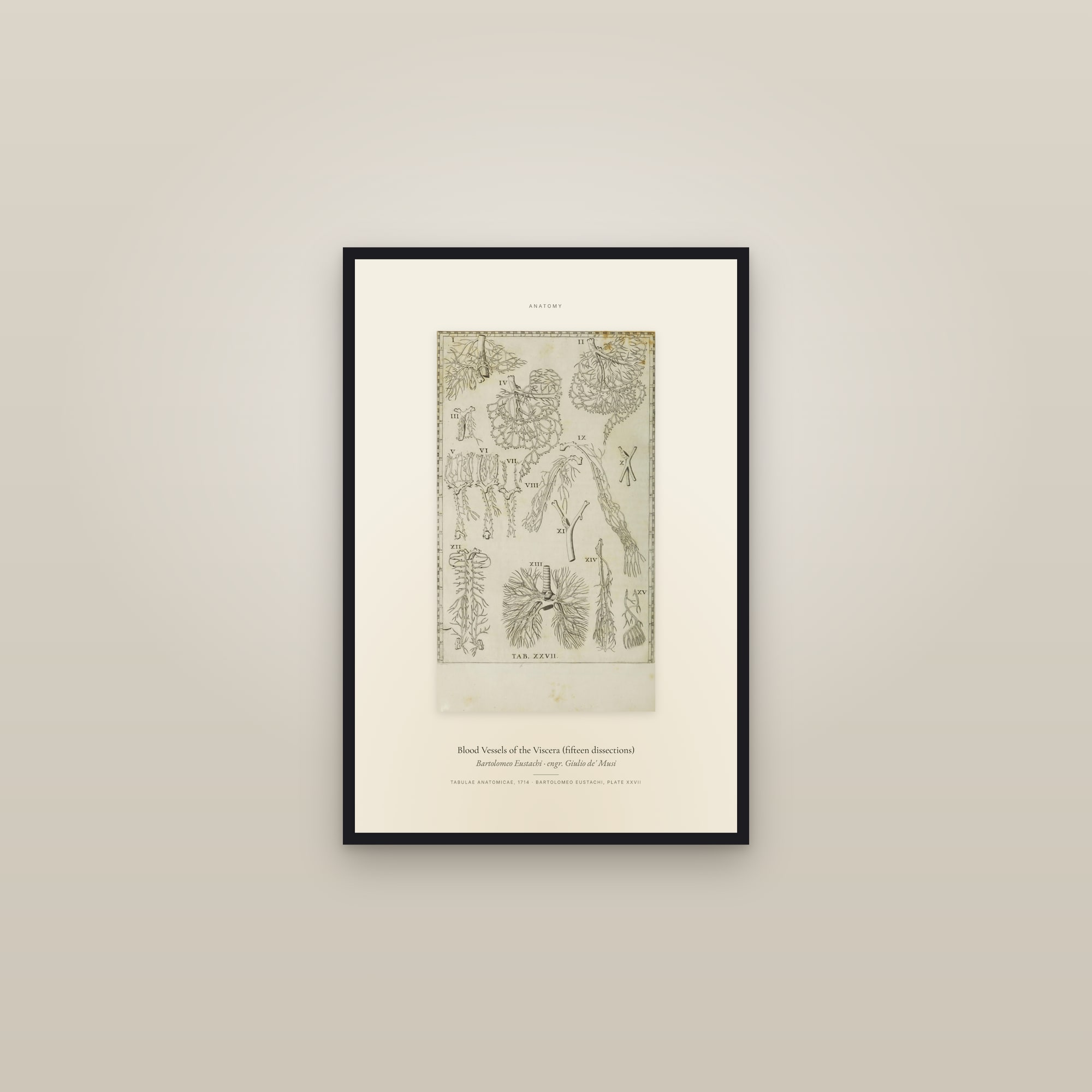 Blood Vessels of the Viscera (fifteen dissections) — Specimen — framed in a gallery setting
