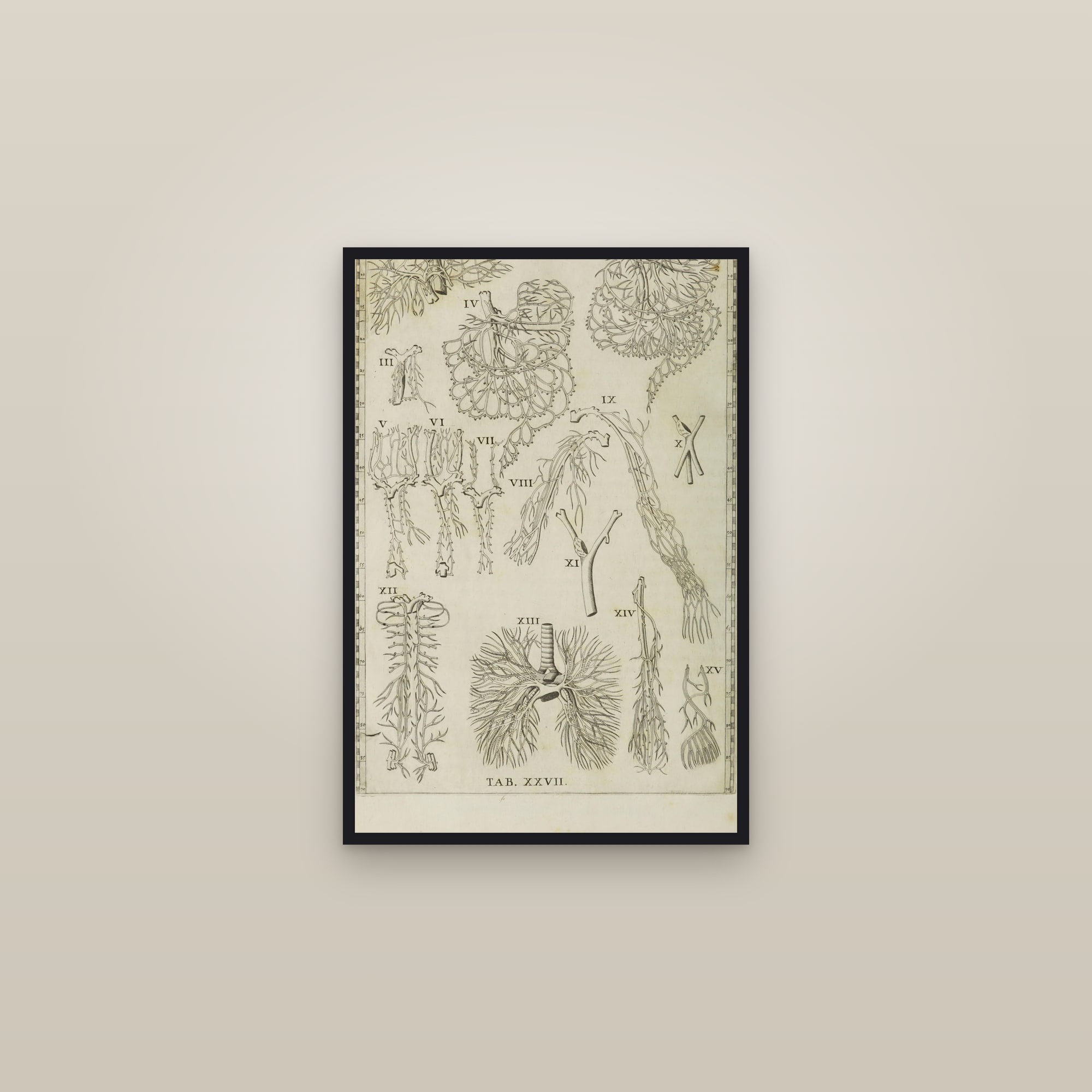Blood Vessels of the Viscera (fifteen dissections) — framed in a gallery setting