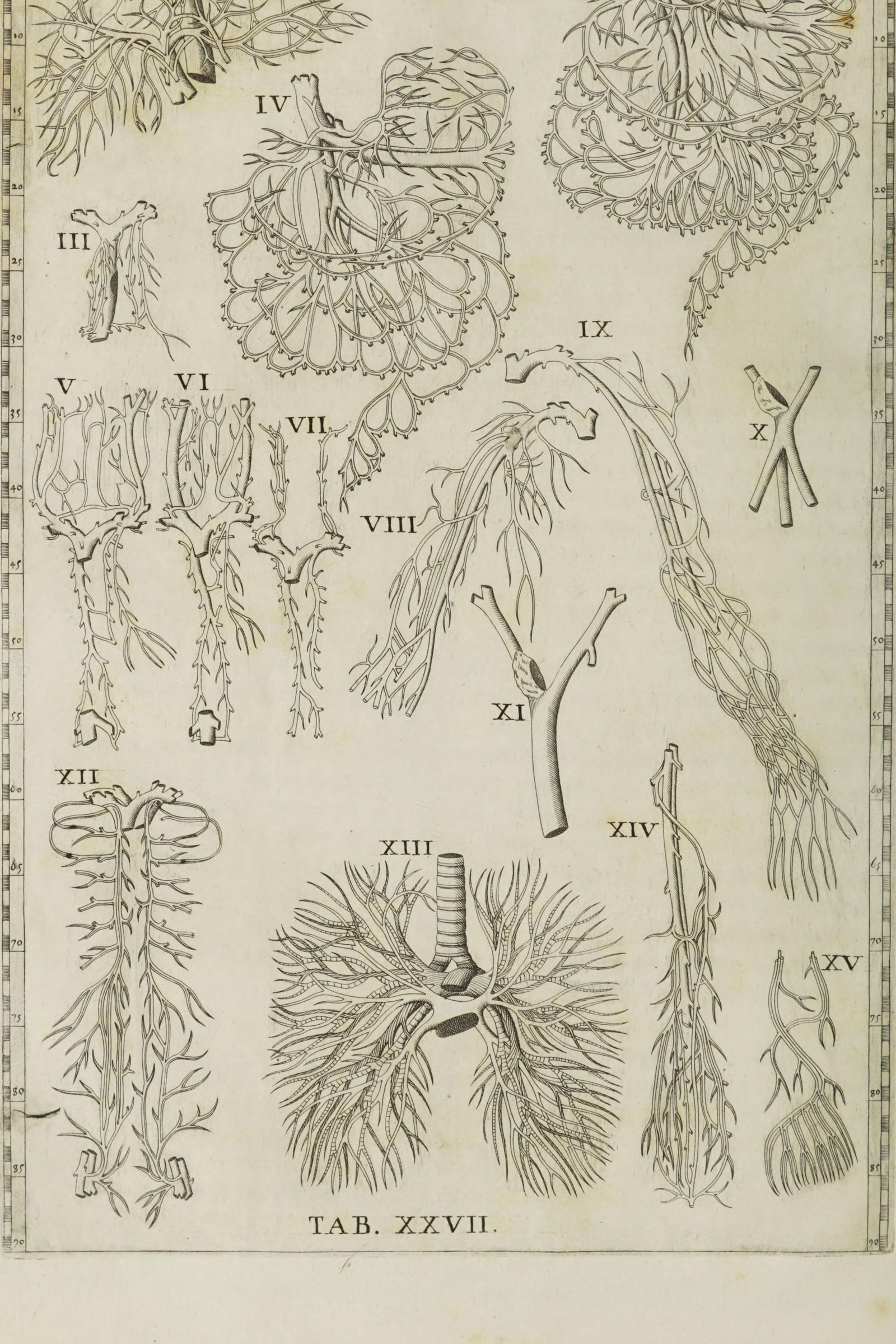 Blood Vessels of the Viscera (fifteen dissections)